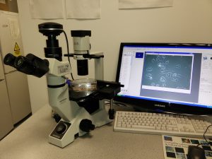 Microscopic examination of drug resistant neuroblastoma cells KellyCis83. Cells look healthy and can be kept for another 2-3 days to form a more dense population.