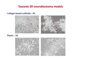 Neuroblatoma cells look like water drops on the cotton wool like collagen scaffolds. In contrast, when they grow on plastic in 2D, they are flat. Arrows point towards cells.